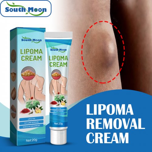 lipoma